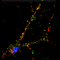 Synapses in mature iPSC cortex neuron Hongjun Song iPSC